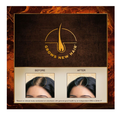 Indulekha Bringha Hair Oil 100 ml